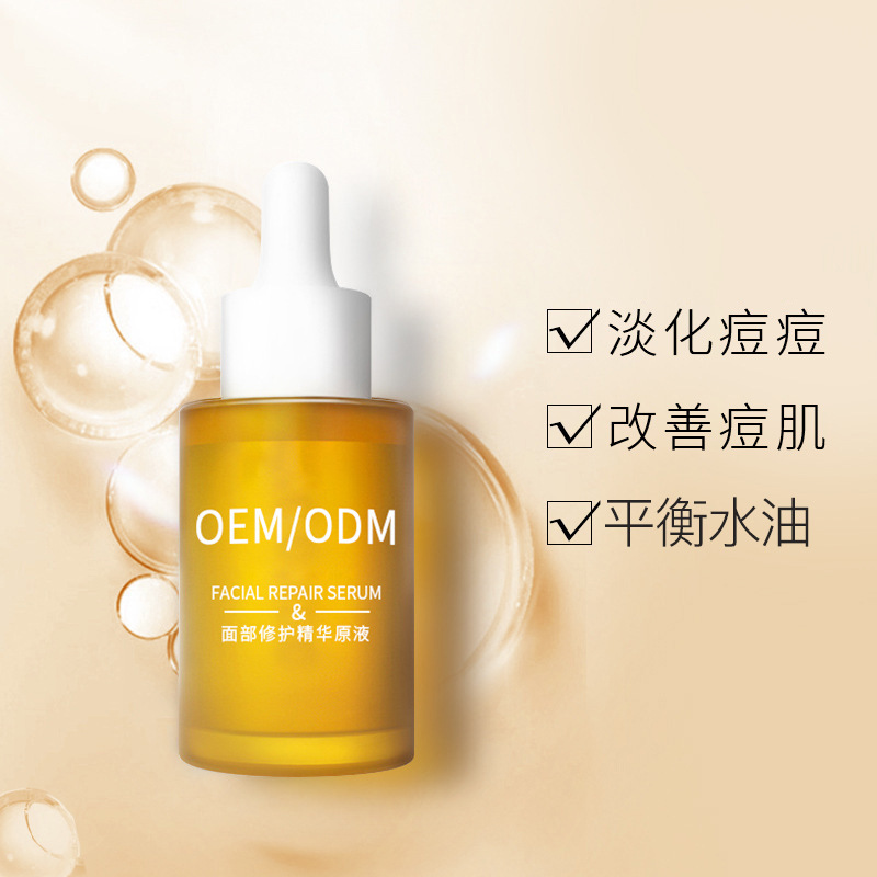 丽江市_祛痘精华原液OEM